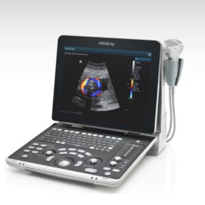 Ultrasonido Z50